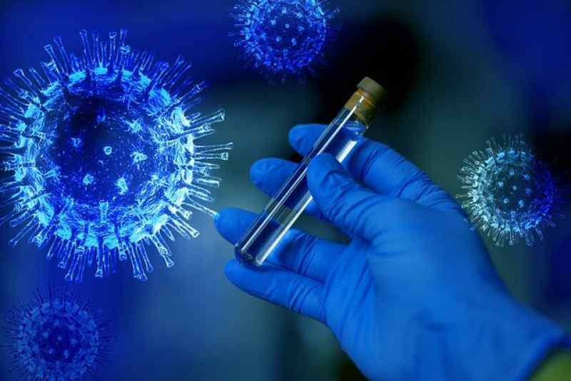 Новосибирец в возрасте 48 лет умер от коронавируса