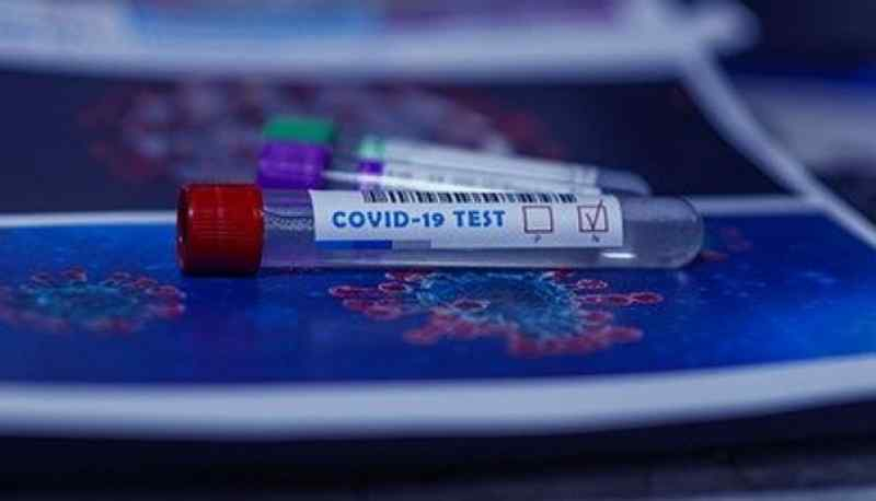 Оперштаб назвал новых жертв коронавируса в Новосибирске